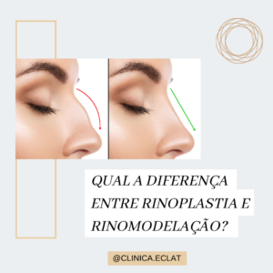 Rinoplastia X Rinomodelação
